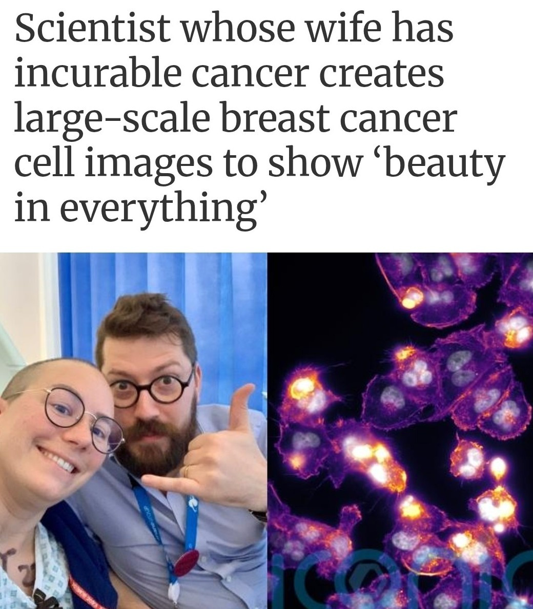 Large-scale breast cancer cell images