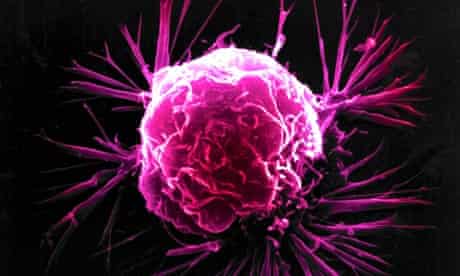 Scientists developing single test to detect risk of four cancers in women