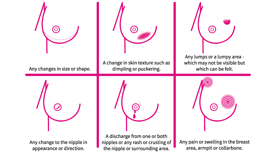 How should I check my breasts?